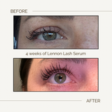 Lash and Brow Growth Serum